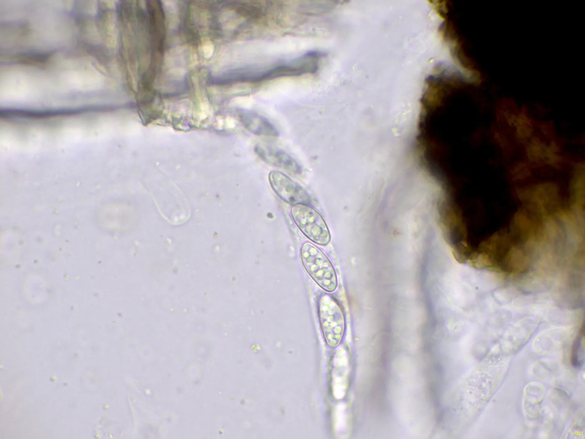 10 - Asco agua-001